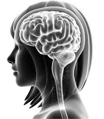 Picture of an xray of a brain